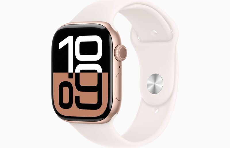 Apple Watch Series 10 Alluminio 46 mm (2024) | GPS + Cellular | rosé dorato | Cinturino Sport M/L | Rosa fard 1